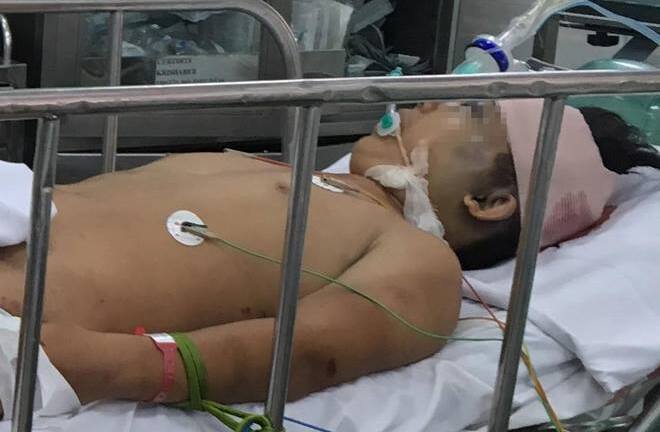 Thiếu niên 17 tuổi rơi xuống sông chấn thương sọ não khi 'đi bão' cổ vũ bóng đá