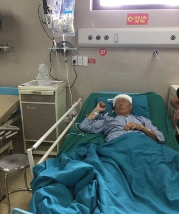 Cụ ông 91 tuổi nói chuyện khi các bác sĩ phẫu thuật não