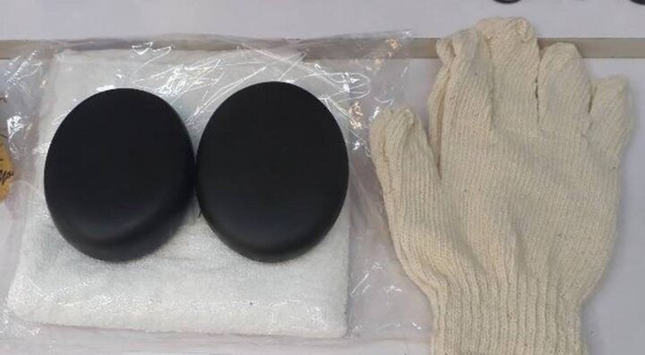 Chữa tiểu đường bằng ‘cặp đá thần kỳ’, cụ ông bỏng nặng, nhập viện khẩn cấp