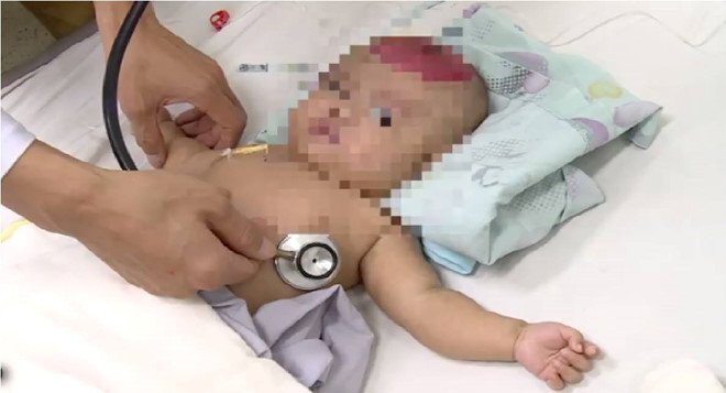 Bé gái hai tháng tuổi bị chấn thương sọ não do điện thoại rơi trúng đầu