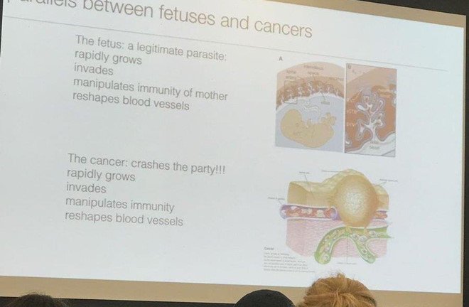 Gọi bào thai là ký sinh trùng, giáo sư Mỹ bị chỉ trích gay gắt