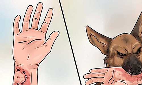 Bé trai lên cơn dại và qua đời sau hai tháng bị chó cắn