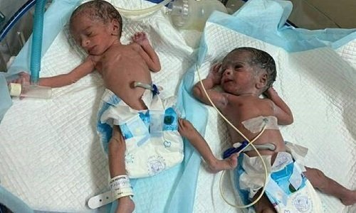 Cụ 73 tuổi sinh thường hai bé gái