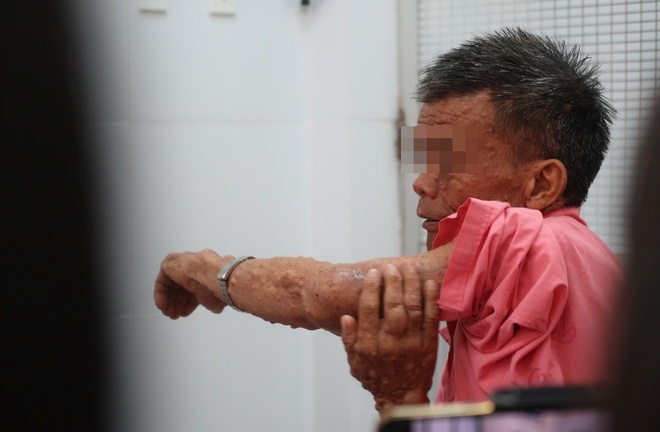 Thầy giáo mang đôi chân biến dạng suốt 20 năm lên bục giảng