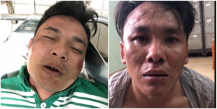 Cảnh sát nổ súng bắt cướp ở TP.HCM: Thông tin mới nhất