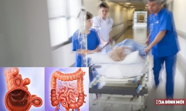 Bị phình ruột tới 18 cm, vỡ ruột suýt chết chỉ vì táo bón lâu ngày