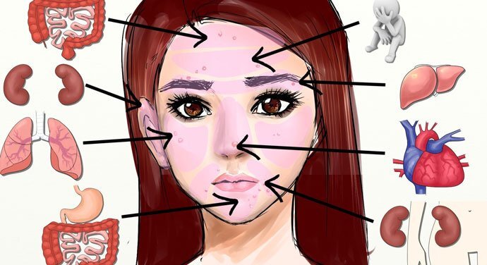 Bắt bệnh cực chuẩn với 7 vị trí mọc mụn trên mặt