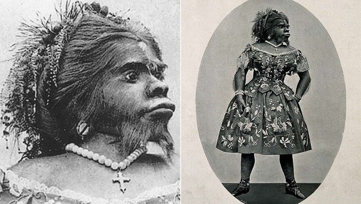 Cuộc đời bất hạnh của người phụ nữ xấu xí nhất thế giới