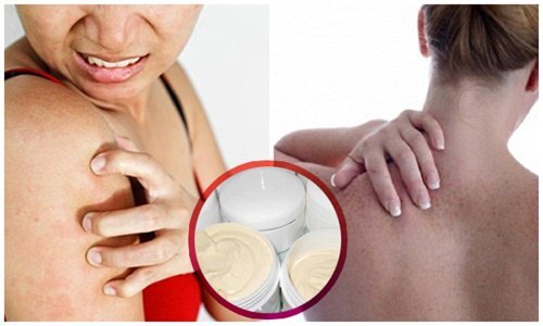 Sau khi đọc xong bài viết này, chị em sẽ không dám sử dụng kem trộn trắng da nữa