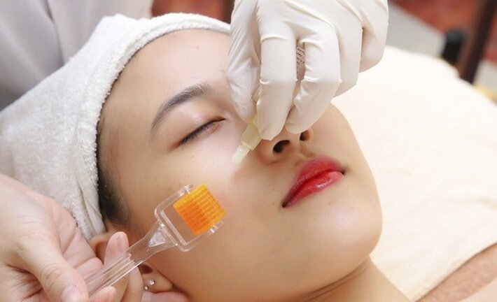 Lăn kim làm đẹp: Liệu có đáng sợ?