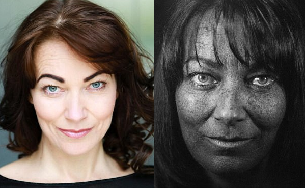 Bị ung thư da ác tính, nữ diễn viên tiết lộ nguyên nhân đáng sợ