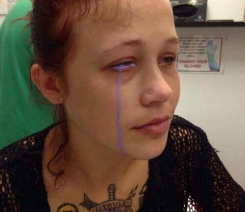 Cảnh báo nguy cơ mất thị giác hoàn toàn do trào lưu xăm tròng mắt