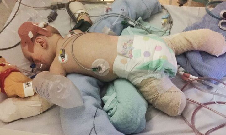 Cậu bé bị viêm màng não hồi phục kỳ diệu sau khi được chẩn đoán chỉ sống thêm vài giờ