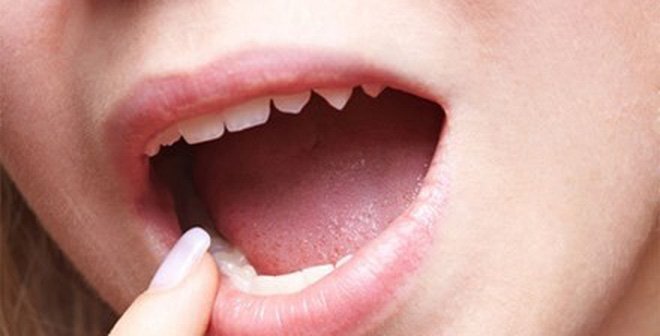 Lè lưỡi soi gương, nhìn màu lưỡi biết ngay bệnh cơ thể