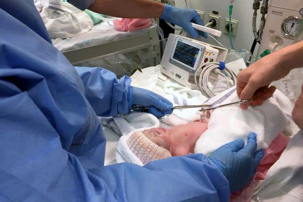 Kỳ diệu ca sinh 3 nhờ thụ tinh ống nghiệm, 1 bé còn nằm nguyên trong bọc ối