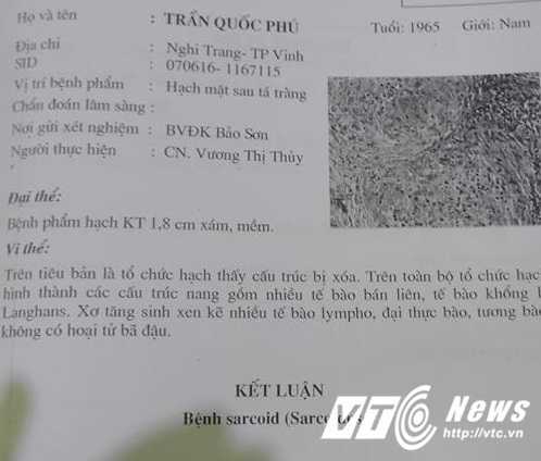 Mổ nhầm tại bệnh viện Bảo Sơn: 'Tôi bất ngờ trước thông tin này'