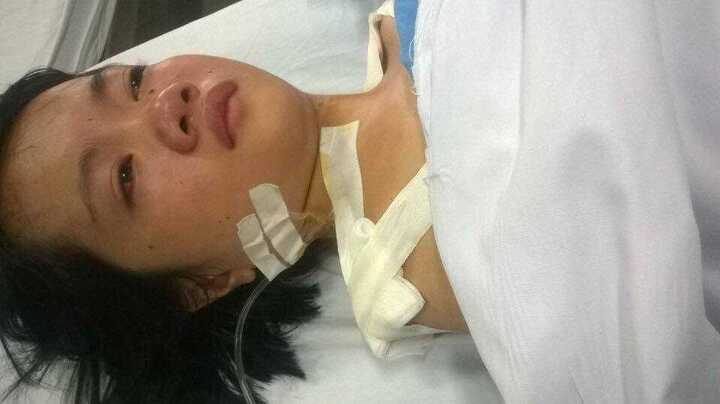 Cô gái không có 2 cánh tay phẫu thuật trước ngày thành tân sinh viên