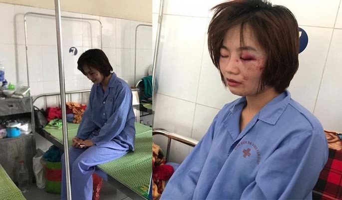 Hai nghi can hành hung nữ phụ xe buýt vẫn chưa ra trình diện