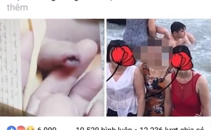 Phụ huynh tố cô giáo đánh chảy máu vùng kín bé trai 3 tuổi: Kết quả xác minh thế nào?