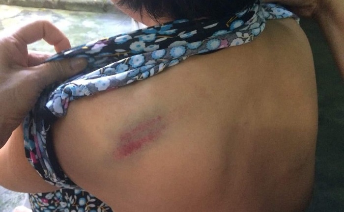 Cháu ngoại đánh bà gãy 5 xương sườn ở Quảng Ninh: Gia đình vẫn kiên quyết để pháp luật xử lý