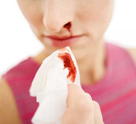 Máu tuôn xối xả sau phẫu thuật xoang mũi do mắc xuất huyết giảm tiểu cầu