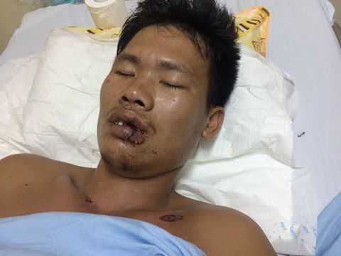 Tìm người nhà bệnh nhân chấn thương sọ não, hôn mê sau tai nạn giao thông