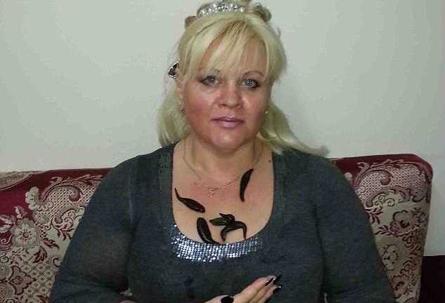 Rợn gáy với liệu pháp giảm cân, cải thiện 'chuyện ấy' nhờ... con đỉa