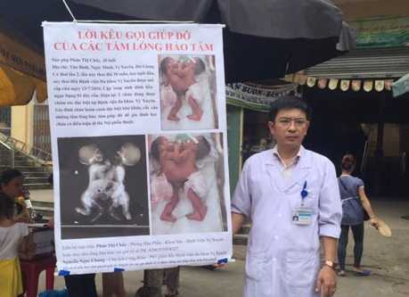 Cảm động tấm lòng Phó giám đốc bệnh viện ra chợ quyên tiền cho 2 bệnh nhi dính bụng