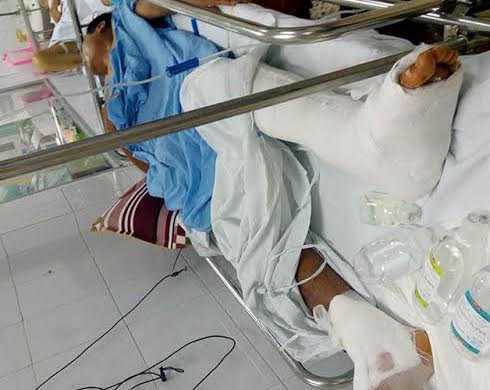 Bệnh viện Việt Đức mổ chân trái lộn sang chân phải: Bác sỹ nhận lỗi vì không xem bệnh án