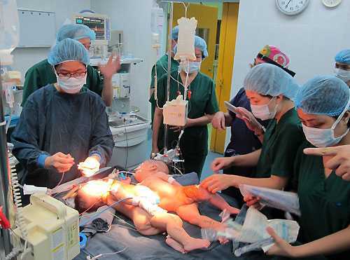 Những ca mổ tách song sinh dính liền lưu danh y học Việt