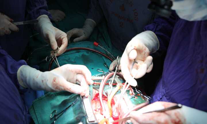 Kỳ diệu khoảnh khắc trái tim đập trong lồng ngực bệnh nhân ngay sau ca ghép tạng