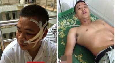 Truy bắt nhóm giang hồ vác dao kiếm đến quán karaoke chém gục 2 người