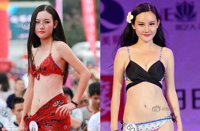 Siêu mẫu Trung Quốc công bố ảnh nâng ngực, sửa mặt