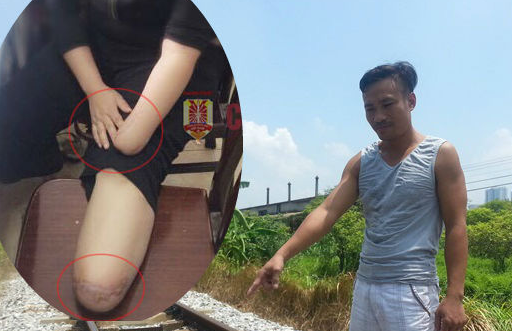 Nhân chứng cứu người phụ nữ tự chặt tay chân tiết lộ những tình tiết bất ngờ