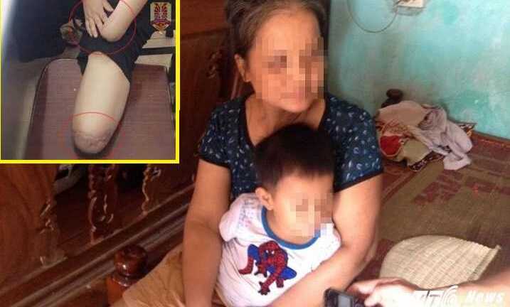 Người phụ nữ thuê người chặt tay chân: Cô con dâu khiến cả nhà chồng điêu đứng