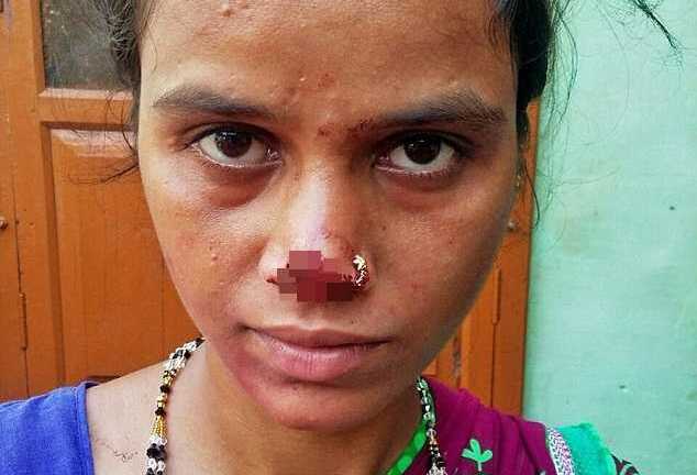 Chồng cắt bay mũi vợ vì không có của hồi môn