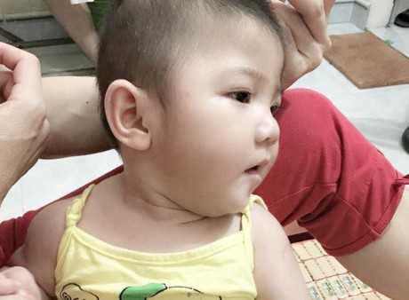 Bất ngờ hình ảnh hiện tại của bé 14 tháng tuổi nặng 3,5kg ở Lào Cai