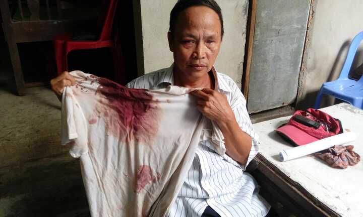 Cha con chi hội trưởng người mù xã bị côn đồ hành hung