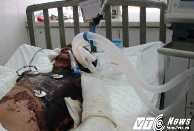 Anh thợ điện 'gà trống nuôi con' bị giật cháy đen, bé gái 4 tuổi ngơ ngác chờ bố về