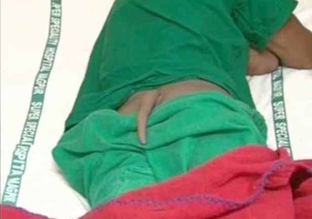 Chàng trai Ấn Độ 'mọc đuôi' dài 20 cm