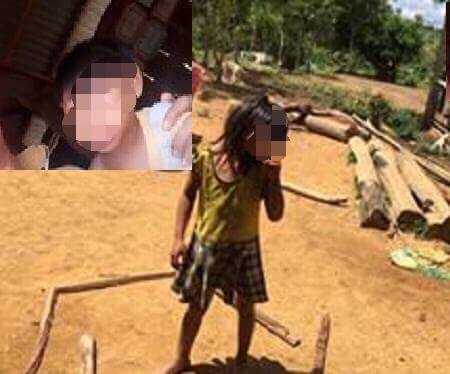 Đắk Lắk: Tiếp tục phát hiện 2 chị em đầu nhỏ nghi nhiễm virut Zika