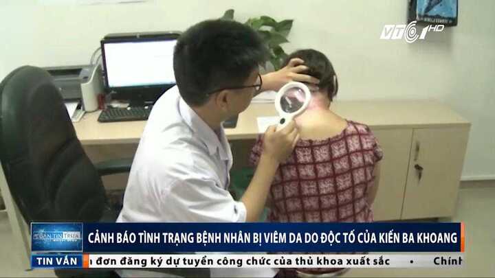 Bệnh nhân viêm da do độc tố kiến ba khoang ồ ạt nhập viện