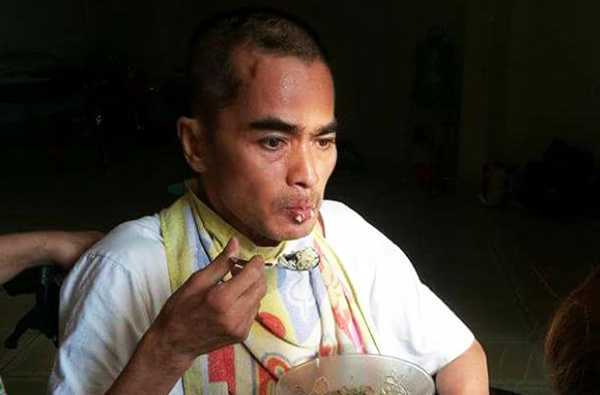 Diễn viên Nguyễn Hoàng đã tự ăn được sau một năm tai biến