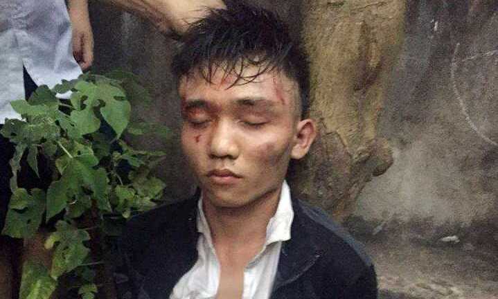 Hà Nội: Cướp giật không thành, cứa cổ chủ cửa hàng tạp hóa