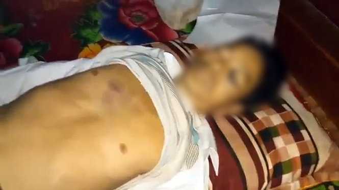 Khám nghiệm tử thi người chết sau một ngày làm việc với công an xã