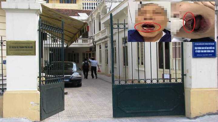 Cán bộ Sở Ngoại vụ Hà Nội hành hung tiến sĩ 76 tuổi sẽ bị xử lý thế nào?