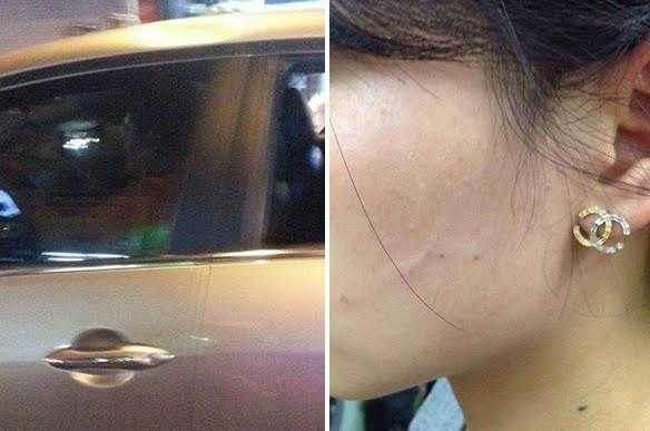 Anh trai tố tài xế xe hơi tát túi bụi em gái vì 'không nhường đường'