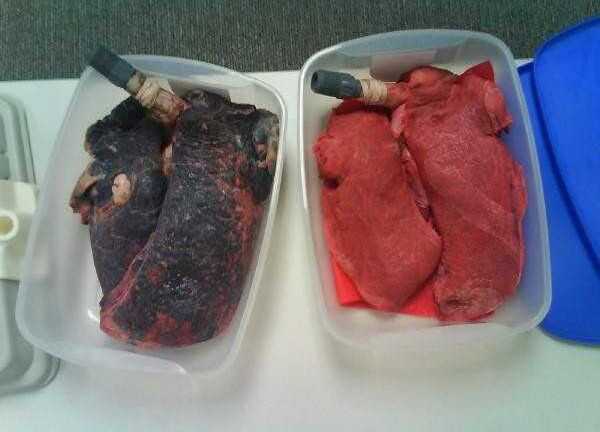 Nhìn lá phổi sau khi hút 60 điếu thuốc, bạn sẽ kinh hãi như thế nào