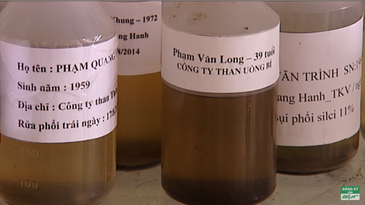 Giật mình với tạp chất như nước thải hút ra từ phổi công nhân ngành than