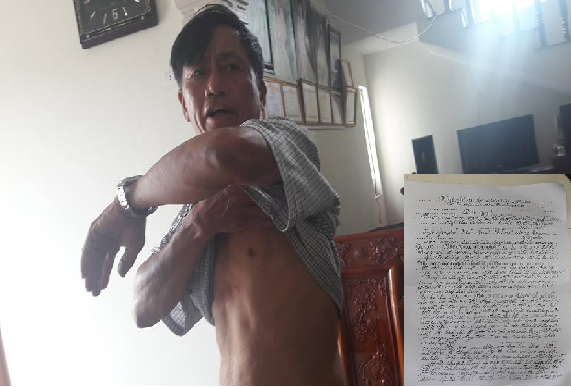 Trưởng thôn tố bị chủ tịch xã hành hung ngay tại trụ sở ủy ban